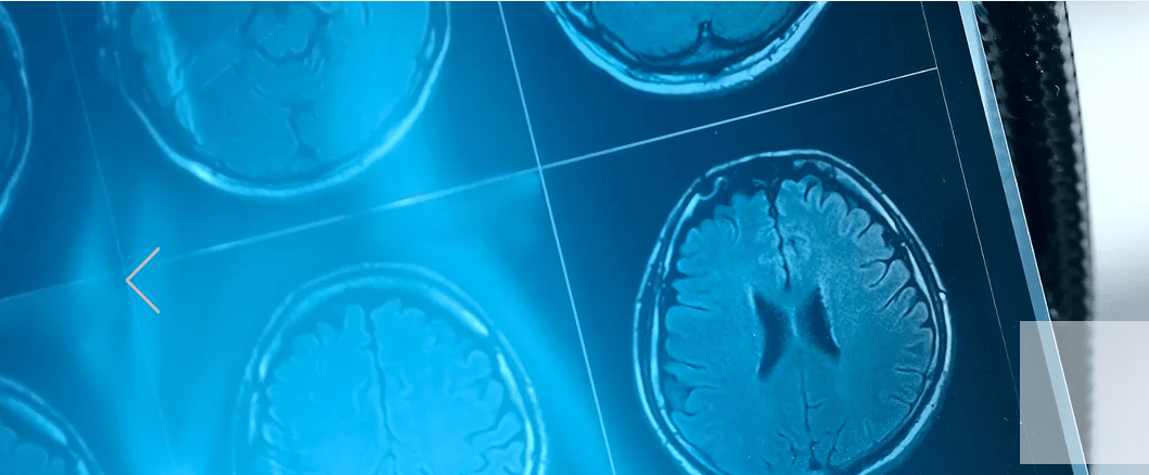 Il Brain Lab IULM premiato all'HD Forum Italia